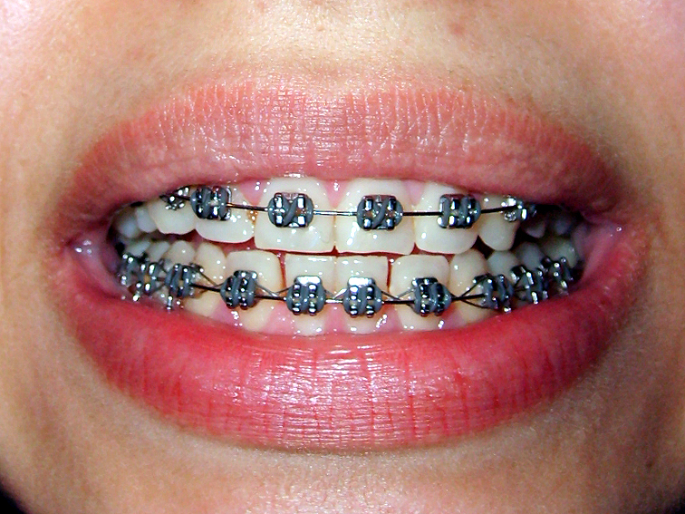 images/ortodonta.jpg45258.jpg